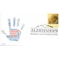 #B6 Alzheimer's Disease CompuChet FDC